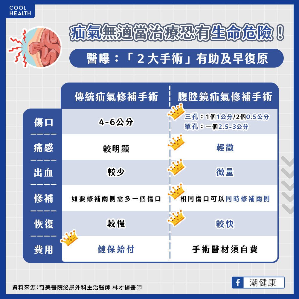 疝氣不治療恐會危及性命？ 醫曝「1手術」減少疼痛加速痊癒