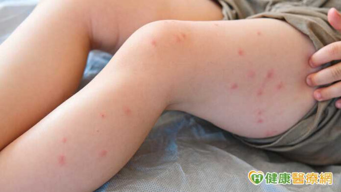 8fadb6e1a5b5b7bda5ebbedd8c236f37_l