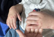 隱匿疫情恐觸法 高雄雙語小學腸病毒事件家長籲徹查