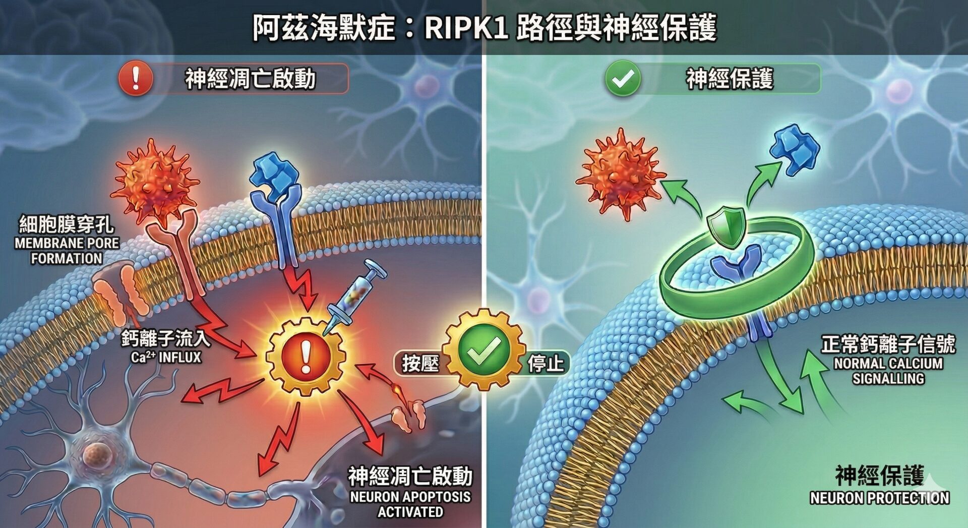 【示意圖：阿茲海默症「RIPK1」路徑與神經保護】左側（問題）： 展示了 TNFR1-RIPK1 結合如何異常激活「死亡開關」，導致細胞膜穿孔、鈣離子流入，最終引發神經元凋亡。右側（解決方案）： 展示了「小分子抑制劑」如何精準地卡在毒性蛋白質之間，防止其結合，從而實現「神經保護」。