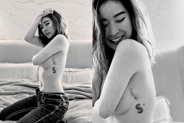 許維恩曬出乳癌術後疤痕。（圖／翻攝許維恩臉書）