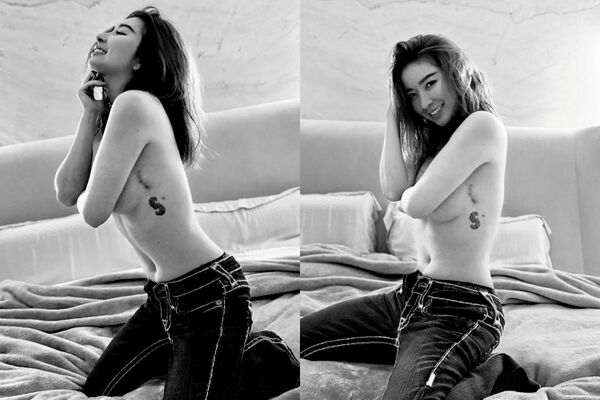 許維恩曬出乳癌術後疤痕。（圖／翻攝許維恩臉書）