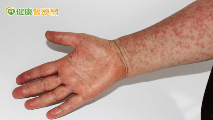 551707c72055e4163db8934c65dc6552_l