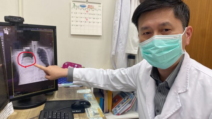 MeeYHRFYomEnrldK55Nd