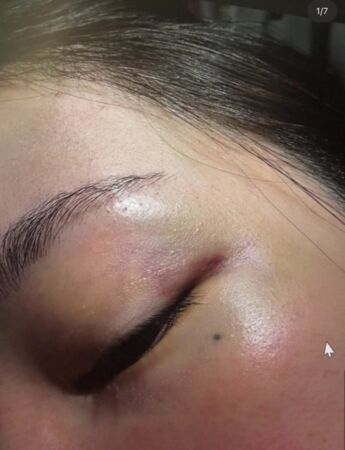 Jisoo親哥妻子出面，控告遭老公家暴。（圖／翻攝theqoo）