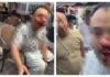 YTR直播吃飯「光頭男一拳拳開扁」! 鏡頭一晃…他整臉都是血