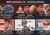檳榔危害完整指南:成癮機制、口腔癌風險與戒除方法