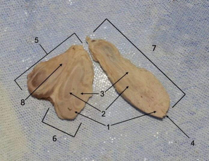 s2026061110240770
