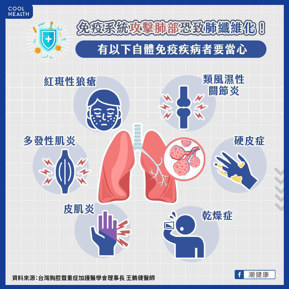 自體免疫疾病更要當心肺纖維化 每3-6月應檢測肺功能