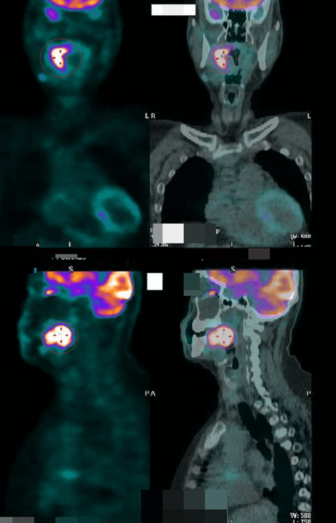 87724-45885001657728659683865109602803972083833579427-601189603616249862